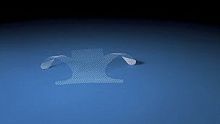 Prolapse reconstruction mesh Direct Fixcystocelehysterocelevaginal approach