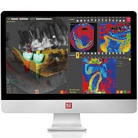 Dental implantology software R2GATEplanningfor dental implant simulationCAM