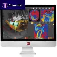 Dental implantology software R2GATEplanningfor dental implant simulationCAM