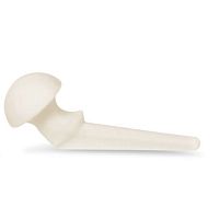 Temporary hip spacer