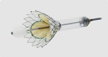 Mitral valve bioprosthesis Cardiovalvesutureless