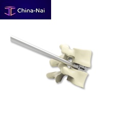 Lumbar interbody fusion cage ELYONanteriortitaniumexpandable