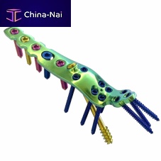 Ankle arthrodesis plate HJ-VA-LOC 02lockingtitanium