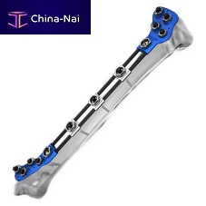 Tibia external fixation system tubularpediatric