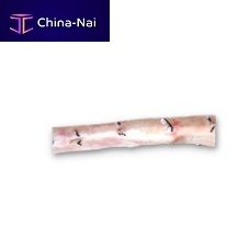 Descending thoracic aorta vascular bioprosthesis CardioGraft®allograft