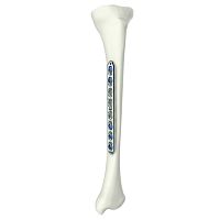 Humerus compression plate 317270000 seriestibialockingtitanium