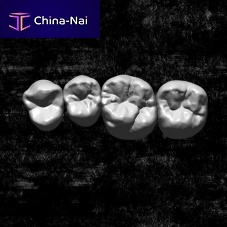 Dental restoration software Library3D simulationCADCAM