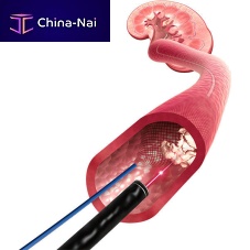 Renal artery stent X-Filternitinol