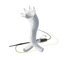 Abdominal aorta stent graft AFX® ePTFE