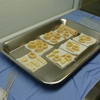 Allograft bone substitute for orthopedic surgeryrigidpowder