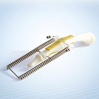 Metatarsophalangeal joint external fixation system FINGERFIXtubularadult
