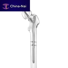 Proximal fixation intramedullary nail 7500 seriestitanium