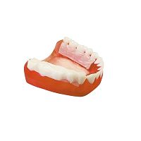Buccal tissue matrix RetissuePLA