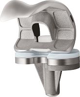 Total knee prosthesis U2 fixed-bearing
