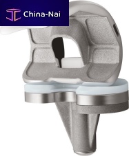 Total knee prosthesis U2 fixed-bearing