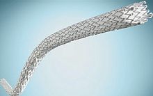 Peripheral stent graft nitinolePTFE