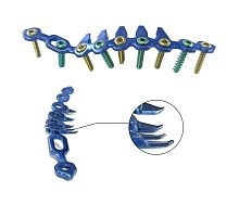 Pelvis compression plate HJ-06posterolateralposteromedialnon-locking