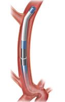 Catheter guidewire Chaperon®hydrophilic