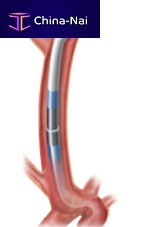 Catheter guidewire Chaperon®hydrophilic