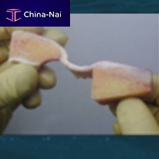 Tibial tendon ligament prosthesis peroneus longus tendonsemitendinosus tendongracilis tendon