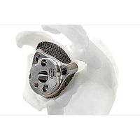 Reverse glenoid cavity prosthesis Gleniusrevisionprimary