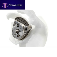 Reverse glenoid cavity prosthesis Gleniusrevisionprimary