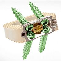 Lumbar interbody fusion cage anteriorPEEK