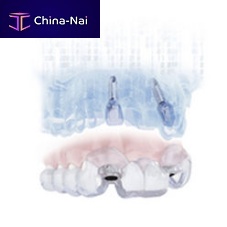 Dental implantology software SIMPLANT®for dental implant simulationplanning