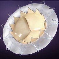 Mitral valve bioprosthesis AccuFit®