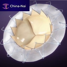 Mitral valve bioprosthesis AccuFit®