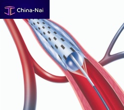 PTA catheter PolarCath sub-popliteal arteryfemoral arteryiliac artery