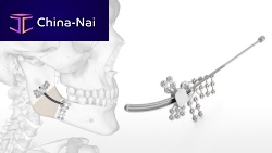 Mandibular distractor Logic internaladult