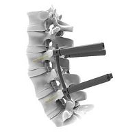 Lumbar osteosynthesis unit CTS 5.5 MISposterioradult