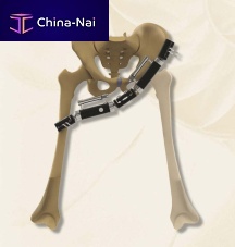 Pelvis external fixation system 40140000100tubularadult