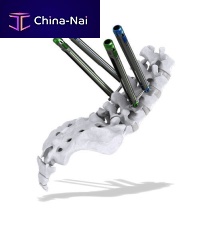 Minimally invasive pedicle screw positioning system Thunderbolt
