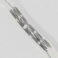 Coronary stent self-expanding
