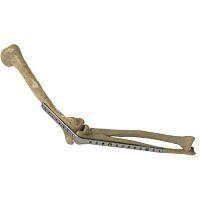 Elbow arthrodesis plate 1222-0010lockingmetallic