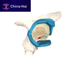 Hip prosthesis resection guide