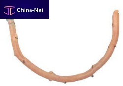 Femoral artery vascular bioprosthesis AngioGraft®femoral veinallograft