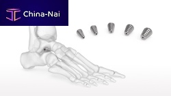 Subtalar joint implant Talar-Fit