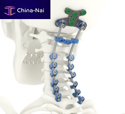 Occipito-cervico-thoracic osteosynthesis unit SOLSTICE®posterioradult