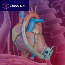 Adult ventricular assist device CH-VAD®