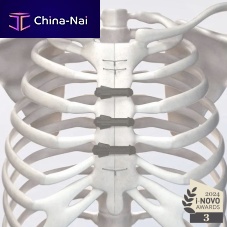 Sternal closure bone cerclage wiring STERN FIXmonofilament polymer
