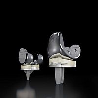 Total knee prosthesis TriVersefixed-bearingcemented