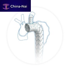 Aortic arch stent graft Castornitinolpolyethylene