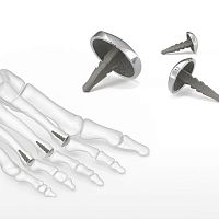 Metatarsophalangeal joint implant EnCompass