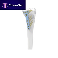 Tibia osteotomy plate lockingmetallic