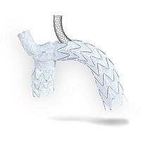 Aortic arch stent graft NEXUS DUO nitinolpolyethylene