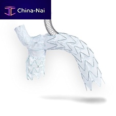 Aortic arch stent graft NEXUS DUO nitinolpolyethylene