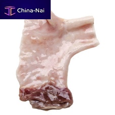 Pulmonary artery vascular bioprosthesis CardioGraft ®allograft